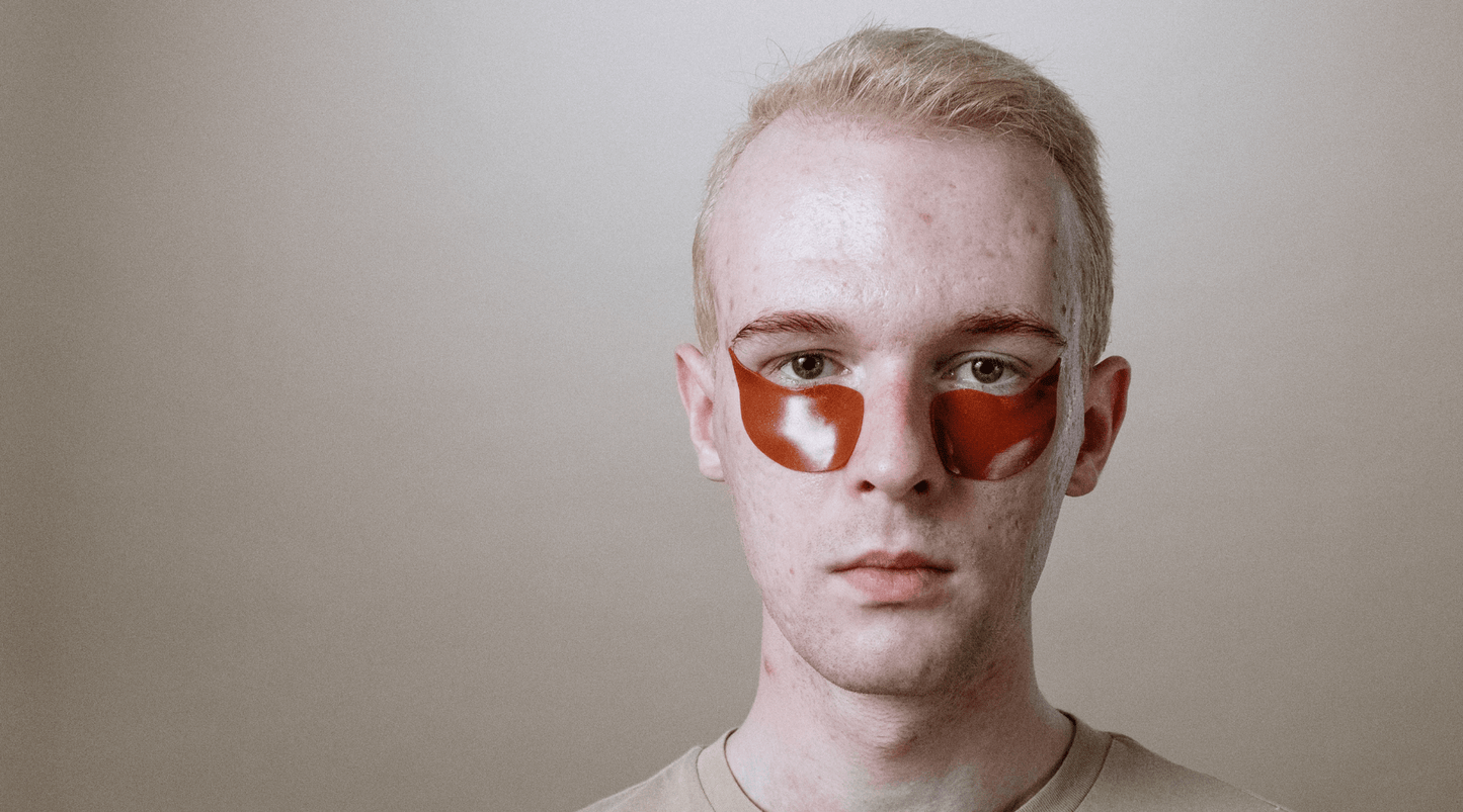 blond man wearing red under-eye masks